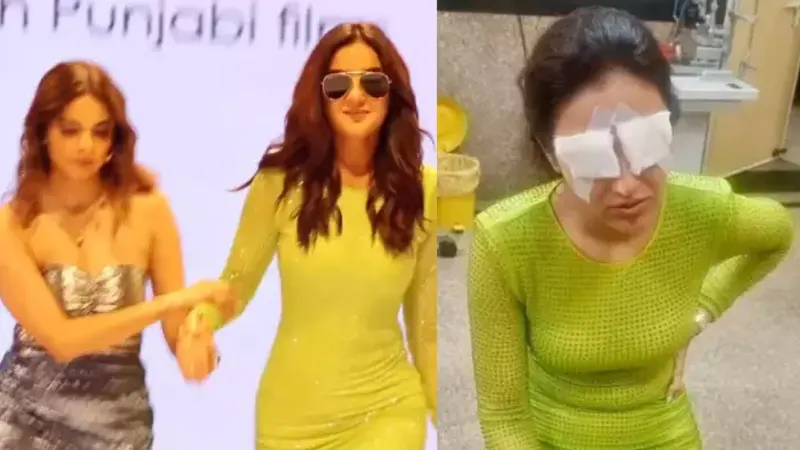 What happened to Jasmine Bhasin, Jasmine Bhasin Eyes, Jasmine Bhasin Eye Injury, Jasmine Bhasin Cornea, Jasmine Bhasin Cornea Injury, All about Jasmine Bhasin Eyes Injury, Jasmine Bhasin Delhi Eye Injury, OTT- True Scoop