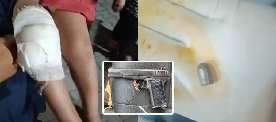 bullet fired in Jalandhar, Jalandhar news, Jalandhar updates, bullet hit 4 year old girl, bullet fire news Jalandhar, 4 year old girl injured, Bullet fire at 4 year old girl, Punjab- True Scoop