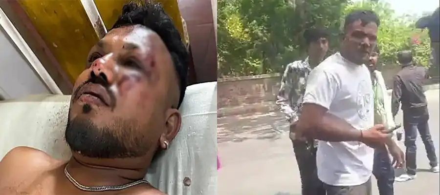 Air India Survivor Ramesh Viswashkumar, How  Ramesh Viswashkumar survived, Who is  Ramesh Viswashkumar, Ramesh Viswashkumar Air India Only Survivor, Ramesh Viswashkumar 11A passenger, India, Trending- True Scoop